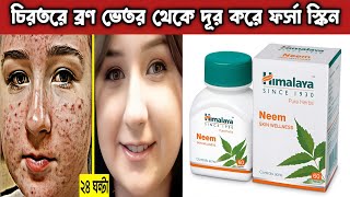 চিরতরে ভেতর থেকে ব্রণ দূর করার ঔষধ  Himalaya Neem Tablet Review Bangla [upl. by Esinaej]