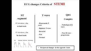 Diagnosis of STEMI [upl. by Naira]