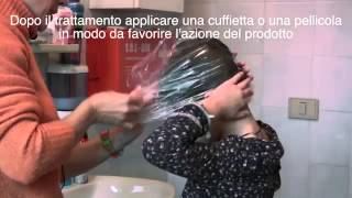 I pidocchi dei capelli versione mod [upl. by Seth993]