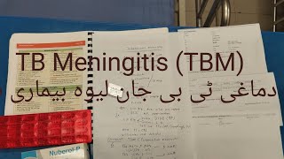 Tuberculous Meningitis TBM CF amp managment دماغی ٹی بی جان لیوہ بیماری ہے [upl. by Gaby429]