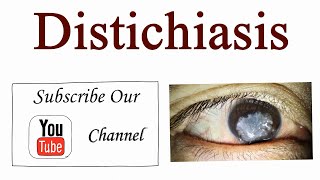 Distichiasis a congenital eyelid abnormality  Optometry Club [upl. by Aicela]