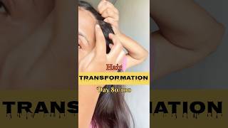 Stop Receding Hairline With These Tips  Natural Solution haircare messywoman shortvideo [upl. by Neruat]