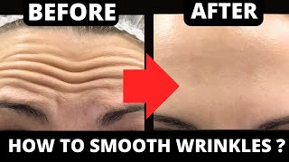 11 MIN  ANTIAGING EXERCISES FOR FOREHEAD LINES  FACIAL EXERCISES FOR FOREHEAD WRINKLES MOUTH [upl. by Ecirtak]