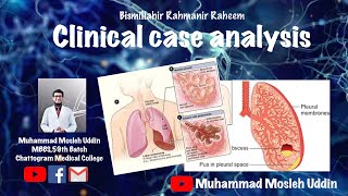 Clinical case analysis  PneumoniaLung abscessPulmonary TB [upl. by Ycart394]