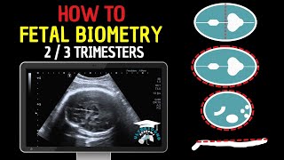 How to Perform Fetal Biometry in the Second and Third Trimesters  Practical Guide [upl. by Hilliard]