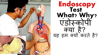 Endoscopy test in Hindi [upl. by Ploch185]