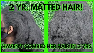 SEVERE MATTED HAIR SHE HASNT COMBED HER HAIR IN 2 YRS [upl. by Banna]