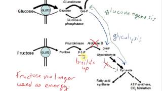 Hereditary Fructose Intolerance HFI [upl. by Occer]