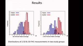 G Zheng Statistical shape modeling of the dysplastic hip Hip Symposium 2016 [upl. by Ihsakat]