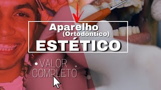 APARELHO ORTODONTICO ESTÉTICO QUANTO CUSTA [upl. by Yerag]