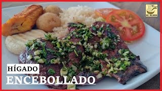 HÍGADO ENCEBOLLADO  RECETAS COLOMBIANAS [upl. by Kessia]