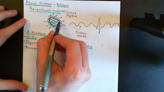 Cardiac Arrhythmias Part 5 [upl. by Okubo]