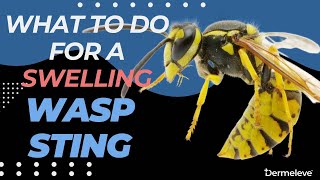 Wasp Sting Still Swelling After 48 hours Heres What You MUST Know [upl. by Ier]