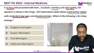 NEET PG Recall 2022 Question  Internal Medicine  Tubercular Meningitis [upl. by Atalaya]