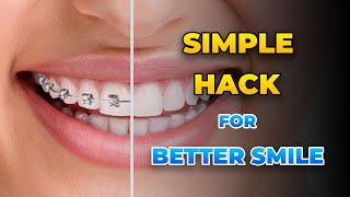 பல் கிளிப் அணிந்தவர்கள் கண்டிப்பாக செய்ய வேண்டியவை  Braces maintanace tips and tricks [upl. by Manfred]