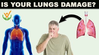 Are You Know About This Chronic Lungs Disease [upl. by Daggna]