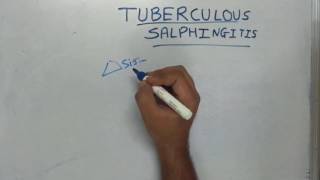 Tuberculous Salphingitis [upl. by Dougald]