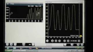 Scan tool data graph vs Lab Scope waveform Throttle Position Sensor Testing [upl. by Hackney]