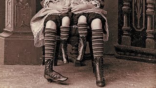 The Story Of Myrtle Corbin The Real Four Legged Girl [upl. by Sivatnod]