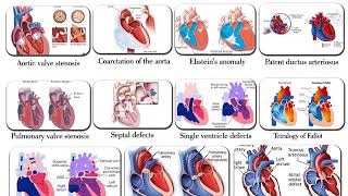 25  BIOL 330  Chapter 14a  Cardiac Part 1 quotAquot [upl. by Munster]