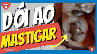 DOR NOS DENTES AO MASTIGAR  Endolovers [upl. by Placidia]