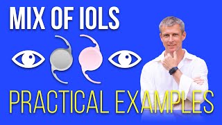 Mixing IOLs for better vision outcomes  practical examples [upl. by Egap766]