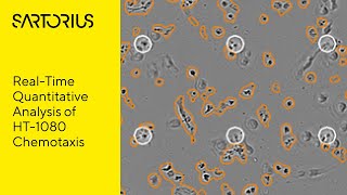 Chemotaxis Cell Migration and Invasion Assay [upl. by Immac]