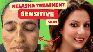 Melasma Treatment for Sensitive skin  Melasma Skincare Routine  Nipun Kapur [upl. by Aihset]