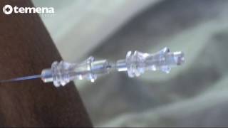 Spinal Anaesthesia with MicroTip® needle Part 22 [upl. by Akaenahs]