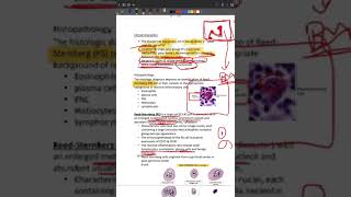 LYMPHOMA HODGKIN TYPE [upl. by Idnat109]