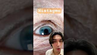 👁️ Nistagmo após Manobra de DixHallpike saude medicina [upl. by Myriam]