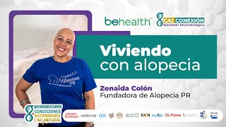 Viviendo con alopecia [upl. by Stacee]