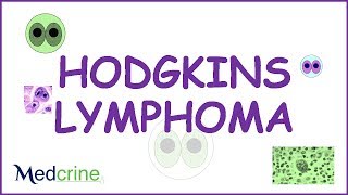 Hodgkins Lymphoma Pathophysiology symptoms and treatment [upl. by Zerep500]