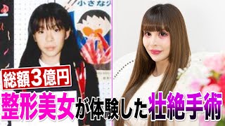 総額3億円！ 全身整形美女ヴァニラが体験した“壮絶手術”とは？ [upl. by Adniram300]