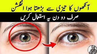 Fast and Effective 1 Best Pink Eye Treatment  Eye Infection [upl. by Aramot115]