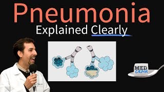 Pneumonia Explained Clearly by MedCramcom [upl. by Kennet456]