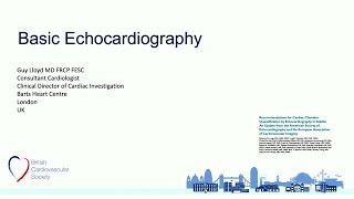 Basic Echocardiography Review echocardiogram [upl. by Yebot326]