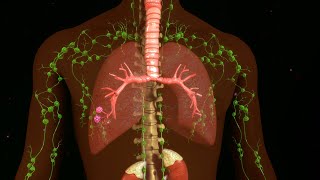 Clinical Charactesistics and Surgical Treatment of Chylothorax [upl. by Yroggerg97]