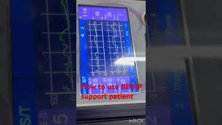 How to use bipap machine  BIPAP support icu patient  BIPAP setup icu patient  bipap shorts [upl. by Neeloc280]