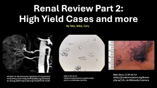 Medicine Shelf Review Renal Review Part 2 [upl. by Ricardama446]