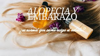 ALOPECIA Y EMBARAZO [upl. by Acinorehs428]