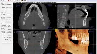 Invivo™ 545 Training Series Introduction to the Section View Tab [upl. by Leoj]