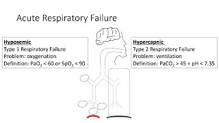 Acute Respiratory Failure [upl. by Maynard]