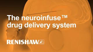 The neuroinfuse™ drug delivery system [upl. by Lulu]