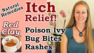 Natural Remedies for Itch Relief Poison Ivy amp Oak Itching Red Clay  Healthy Home Remedy [upl. by Pish468]