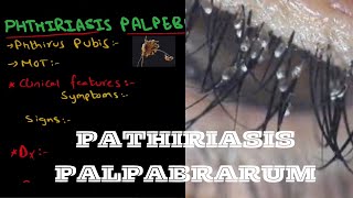 PHTHIRIASIS PALPEBRARUM [upl. by Airat]