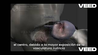 Patología del Sistema Osteoarticular  Parte 6 Displasia de Cadera en Caninos CDD [upl. by Sewellyn]