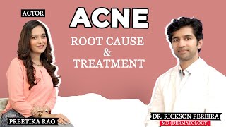 Acne Skin Rash Pimples  Medicines  Treatment MD Dr Rickson Pereira  Skin Problem Preetika Rao [upl. by Ahseinet]