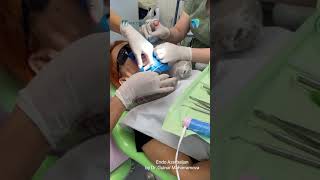 Real world clinical application of rubber dam with Medesy instruments [upl. by Clyte]