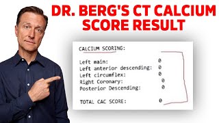 DrBergs Reaction on his CT Calcium Scoring Test Result [upl. by Essam]